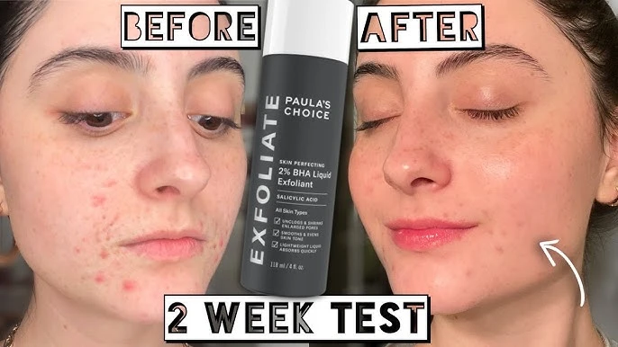 Paula's Choice SKIN PERFECTING 2% BHA Liquid Salicylic Acid Exfoliant - Facial E
