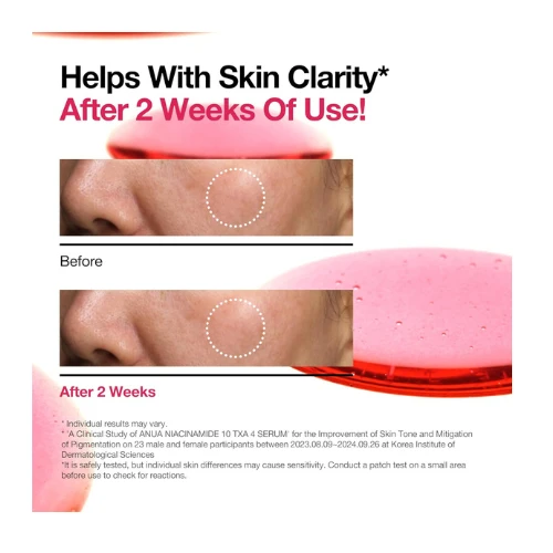 ANUA 10% Niacinamide+ 4% TXA Serum, Ceramide, Hyaluronic Acid, Tranexamic Acid, 