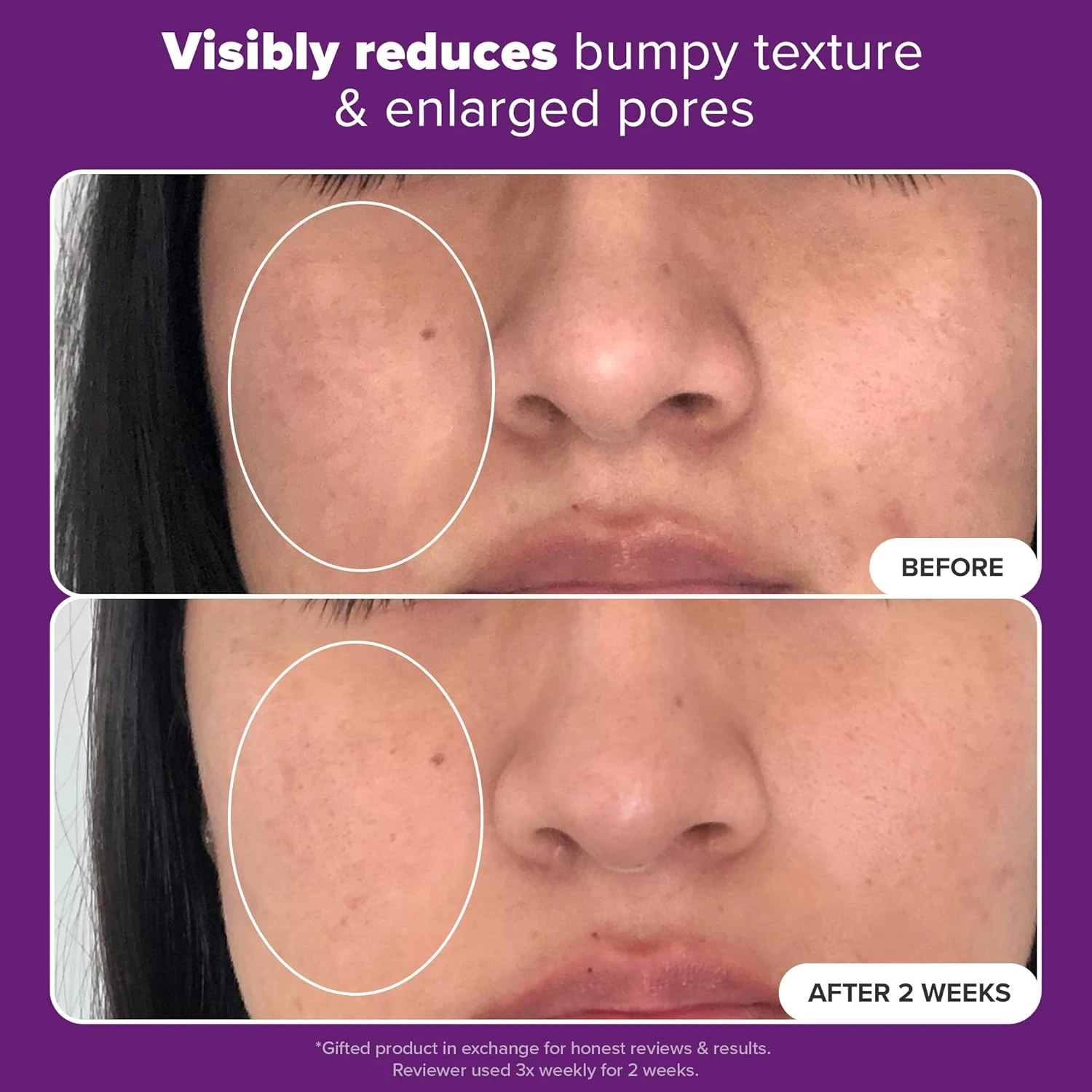 Paula's Choice CLINICAL Niacinamide 20% Treatment Serum