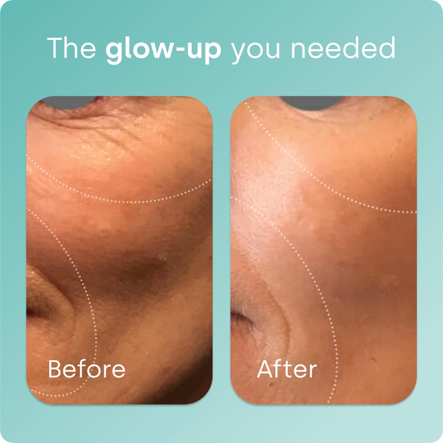 BioSil Collagen Booster Supplement – Patented ch-OSA Activator for Skin, Hair, N