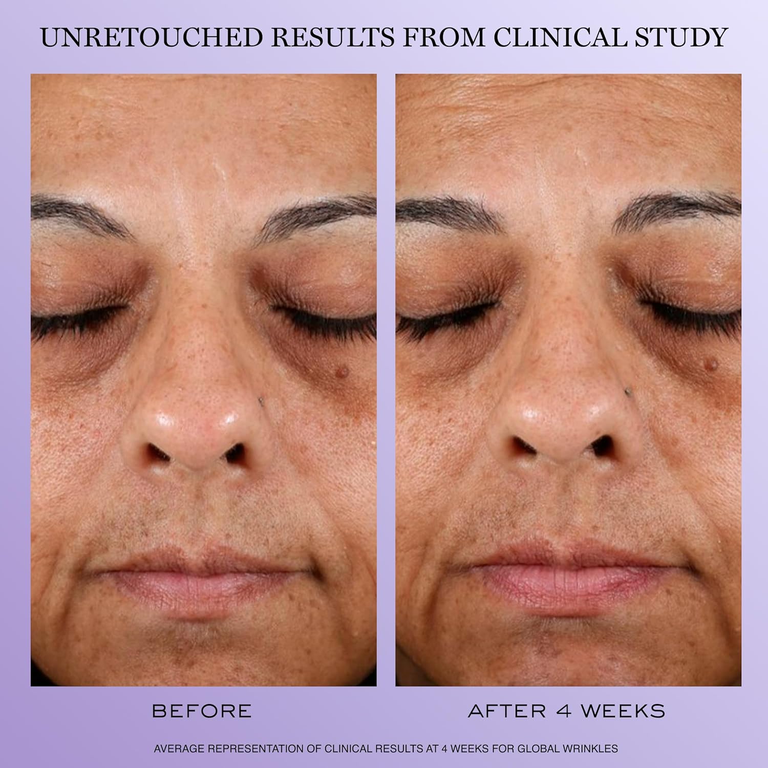 Lancôme Rénergie H.P.N. 300-Peptide Anti-Aging Face Cream – Hyaluronic Acid, Nia