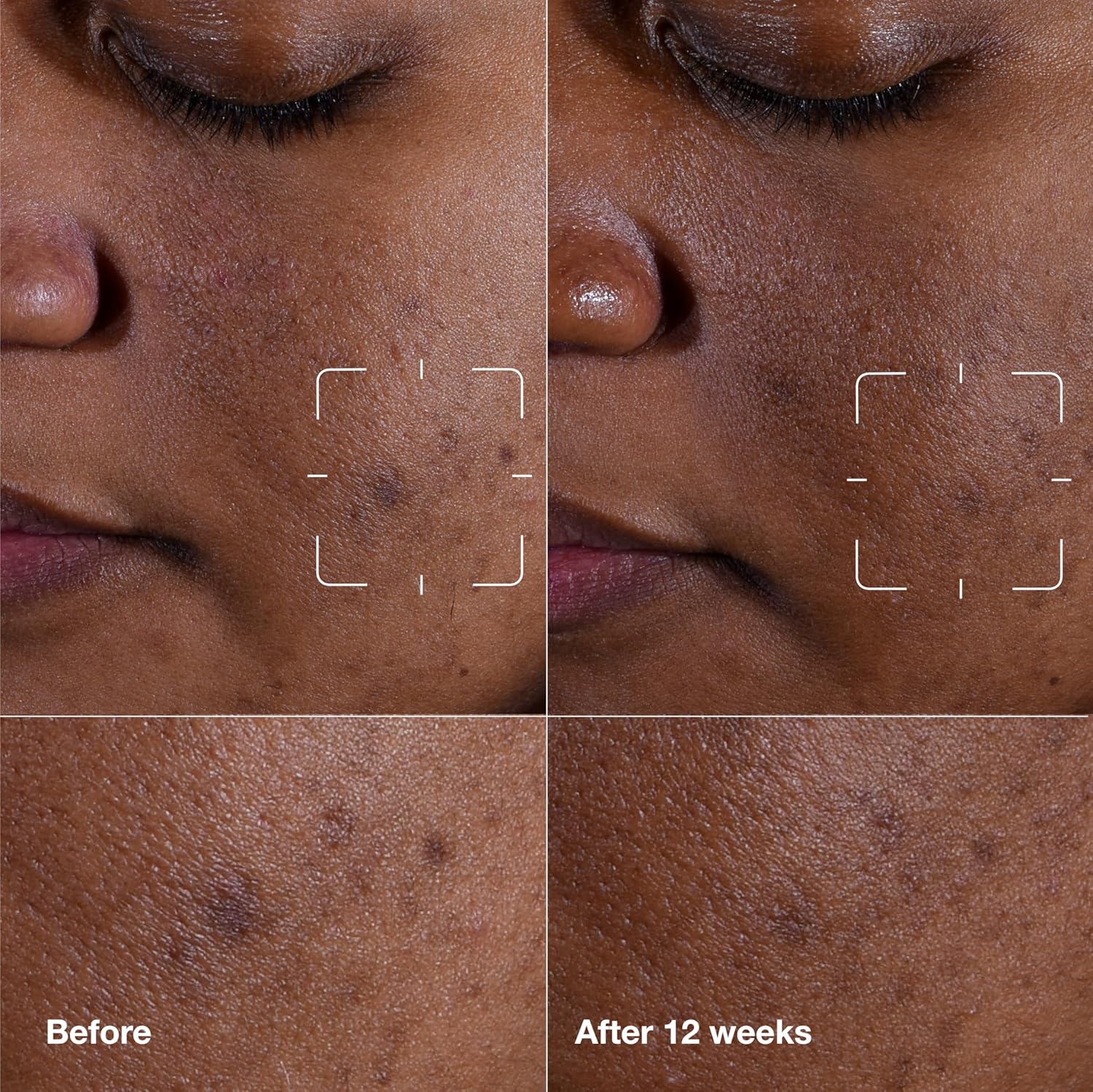 Clinique Even Better Clinical Dark Spot Clearing Vitamin C Face Serum | Brighten