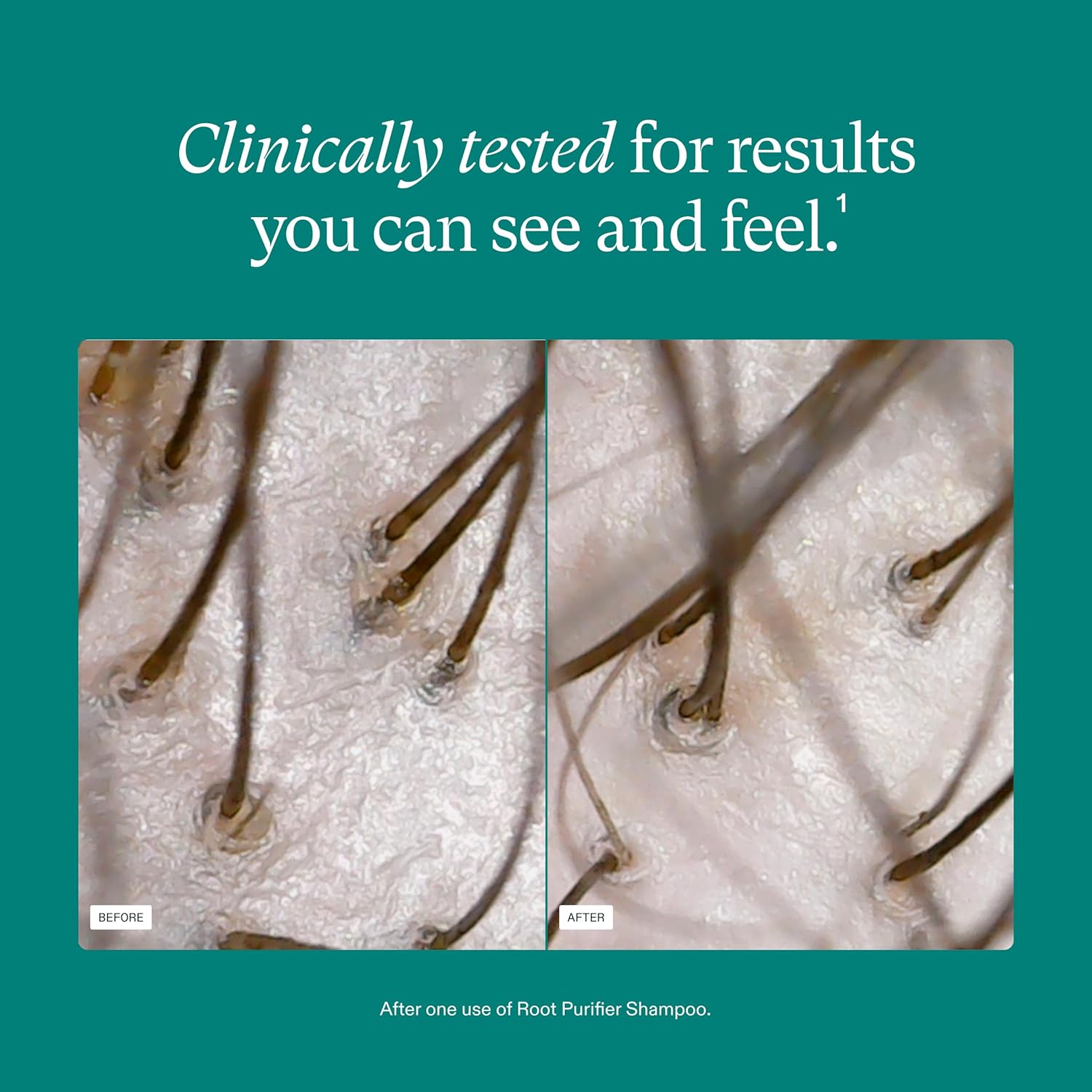 Nutrafol Shampoo for Thinning Hair – Cleanse & Hydrate Hair and Scalp – Improves