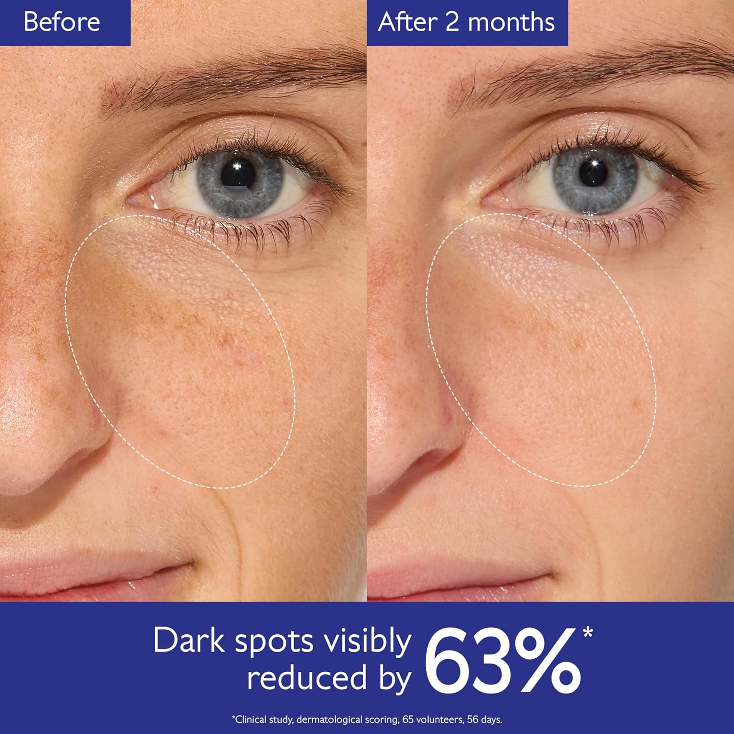 Caudalie Vinoperfect Brightening Dark Spot Serum – Vitamin C Alternative with Vi