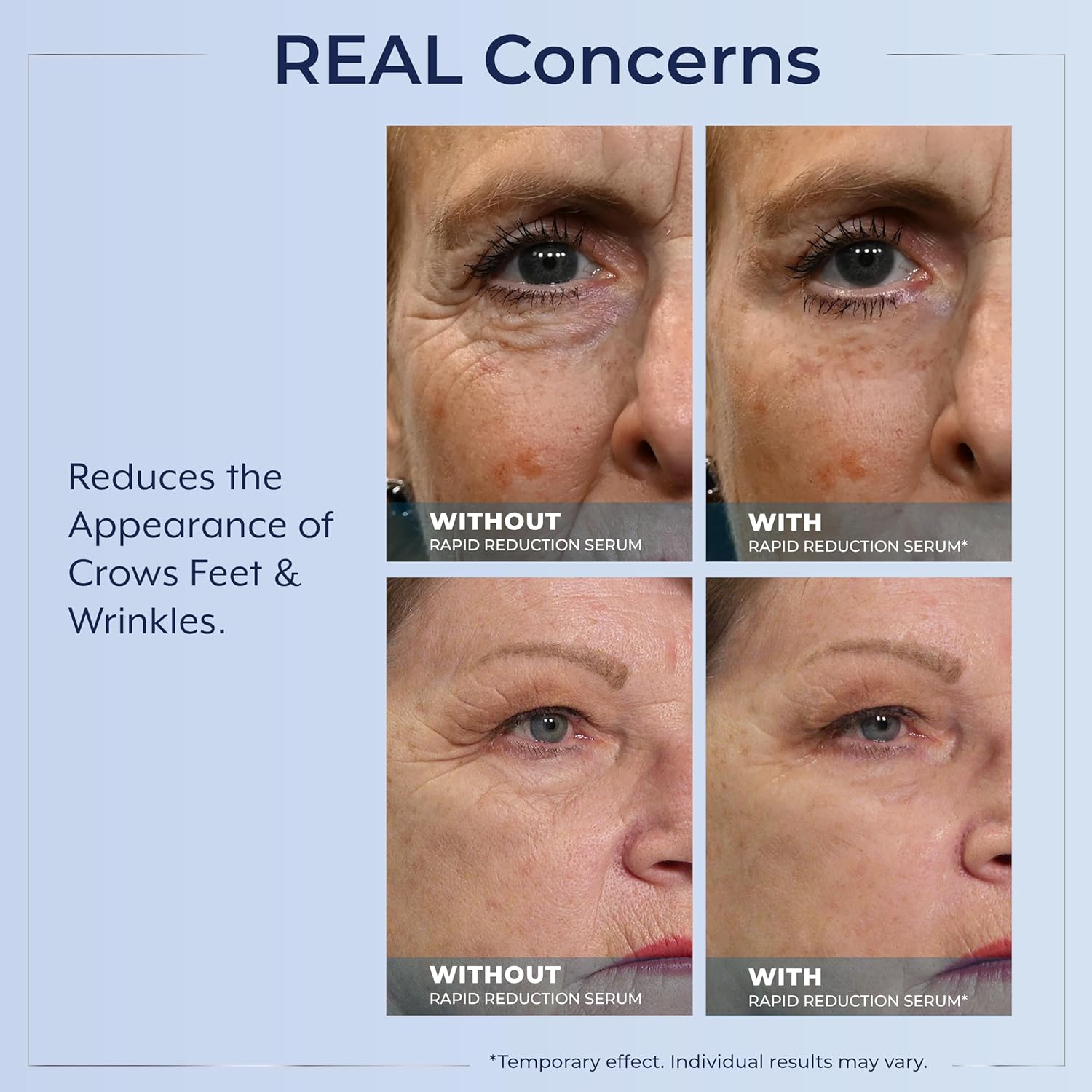 Plexaderm Rapid Reduction Eye Serum – Instantly Reduces Under-Eye Bags, Wrinkles