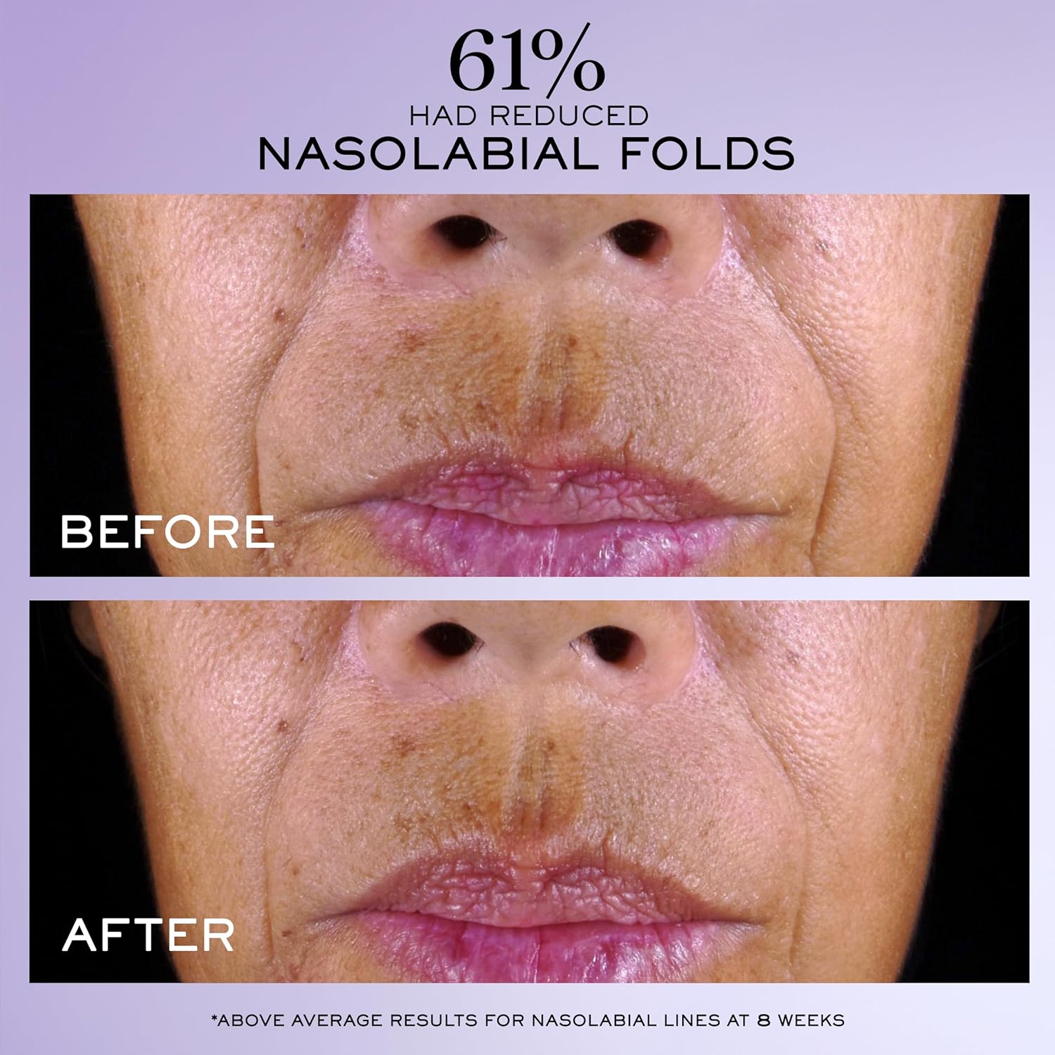 Lancôme Rénergie C.R.x. Triple Serum Retinol – Anti-Aging Face Serum with Pure R