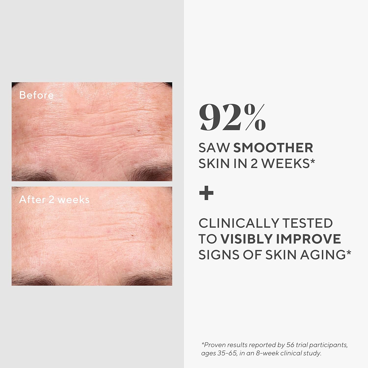 Murad Retinol Youth Renewal Serum – Fast-Acting Anti-Aging Retinol Treatment wit