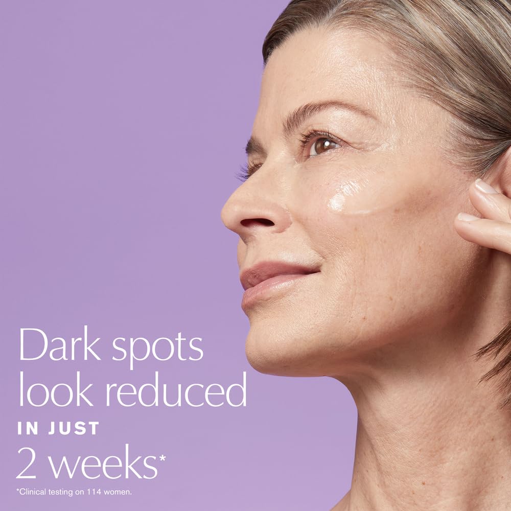 Estée Lauder Perfectionist Pro Rapid Brightening Serum with Vitamin C & Ferment3 – Dark Spot Corrector, 1.7 fl oz